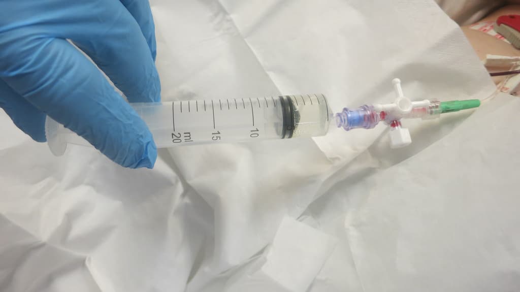 Not every class needs to be injected